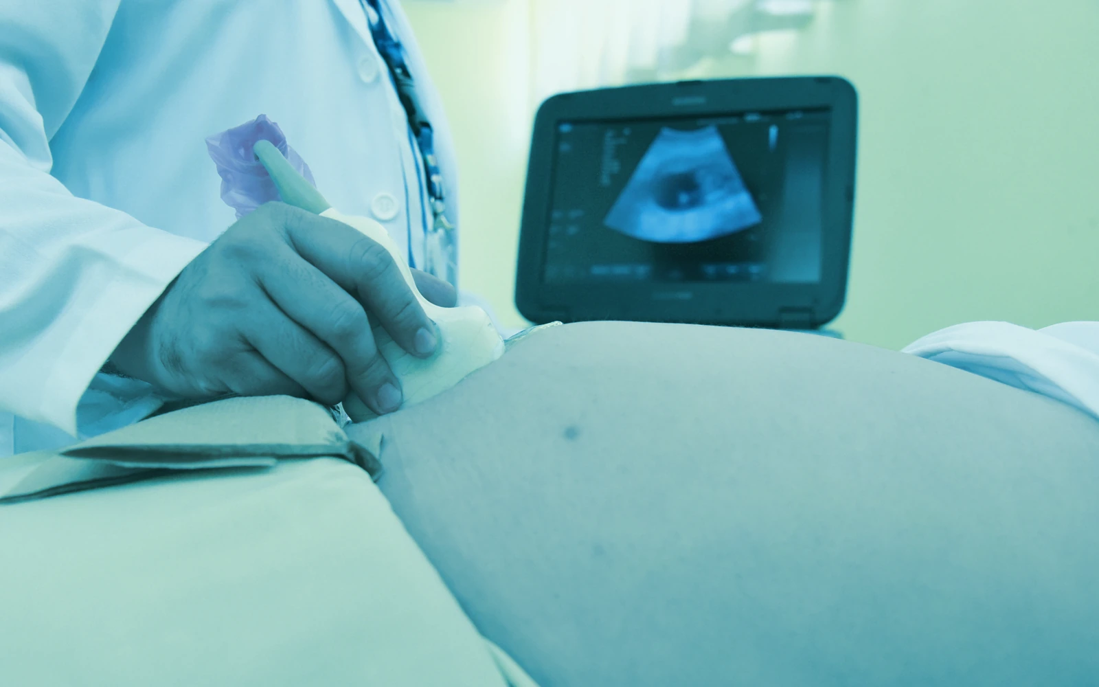 Ultrasound probe in use with the scan visible on a portable monitor