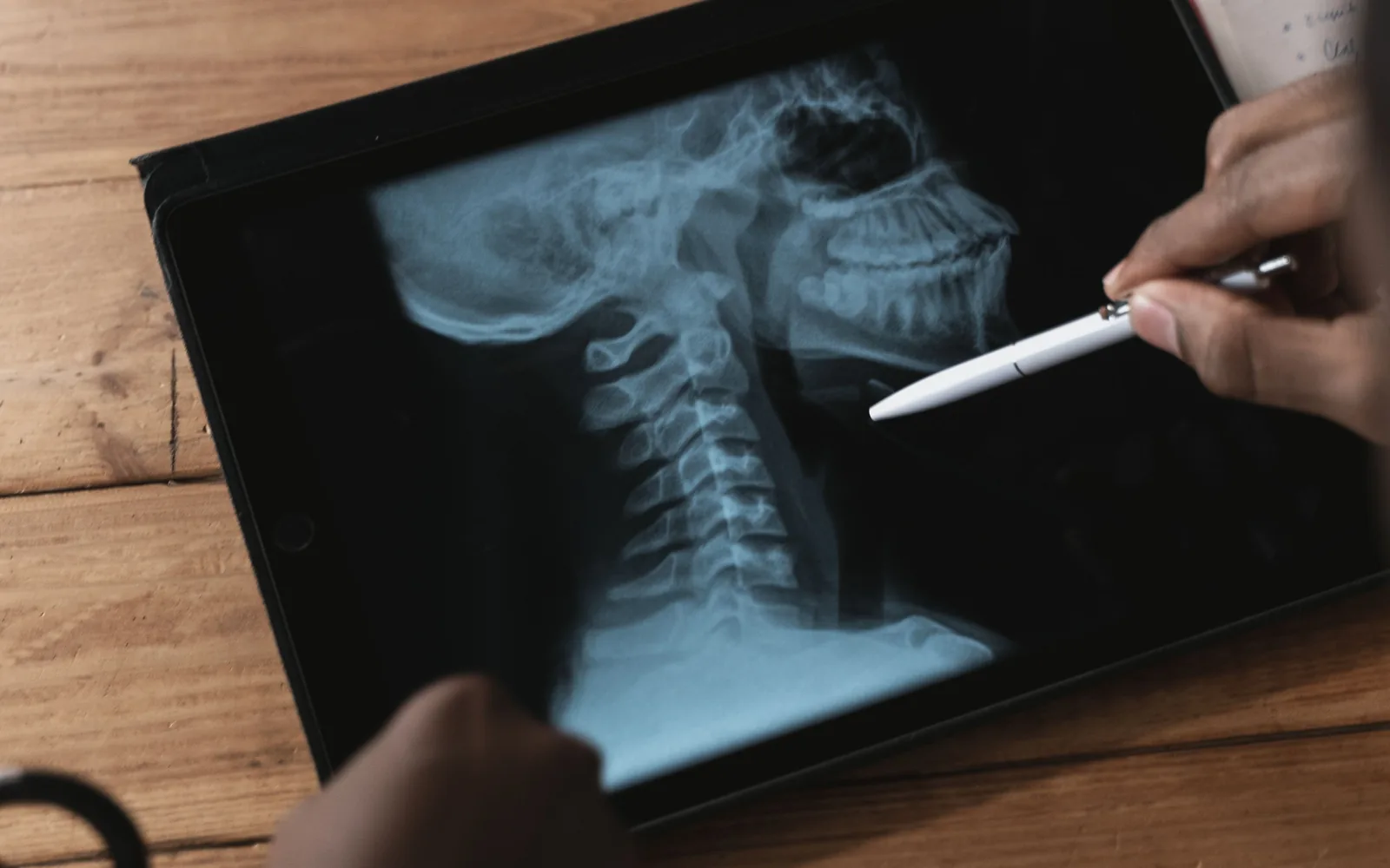 Radiologist marking a digital cervical spine X-ray on a tablet